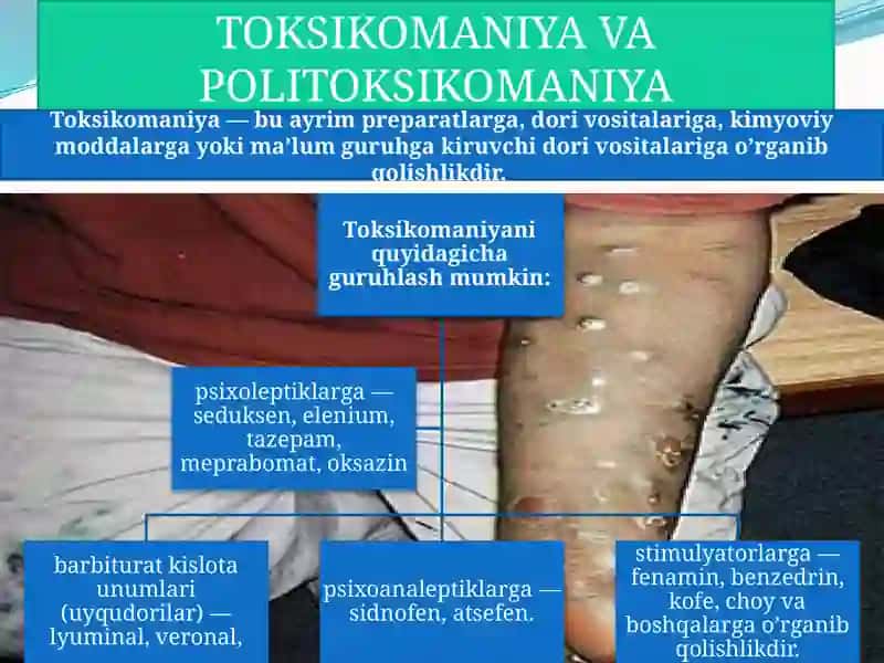 Chekish va unin gprofilaktikasi 4