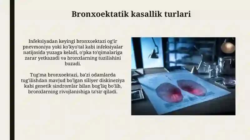 Bronxoektatik kasallik etiologiyasi, klinikasi, diagnostikasi 4