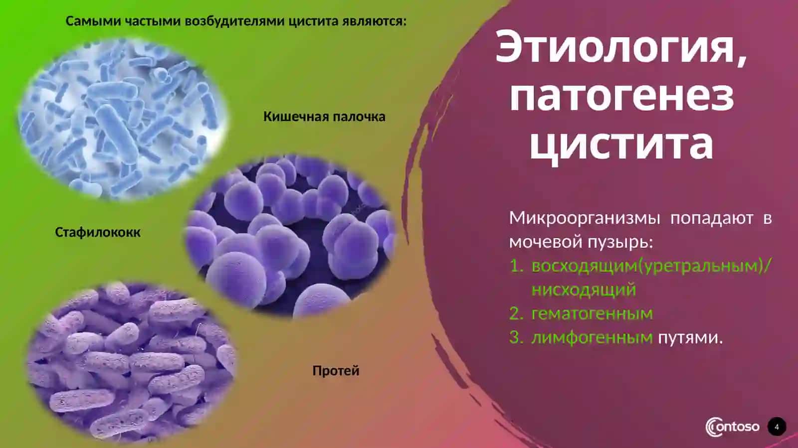 Цистит уретрит 4