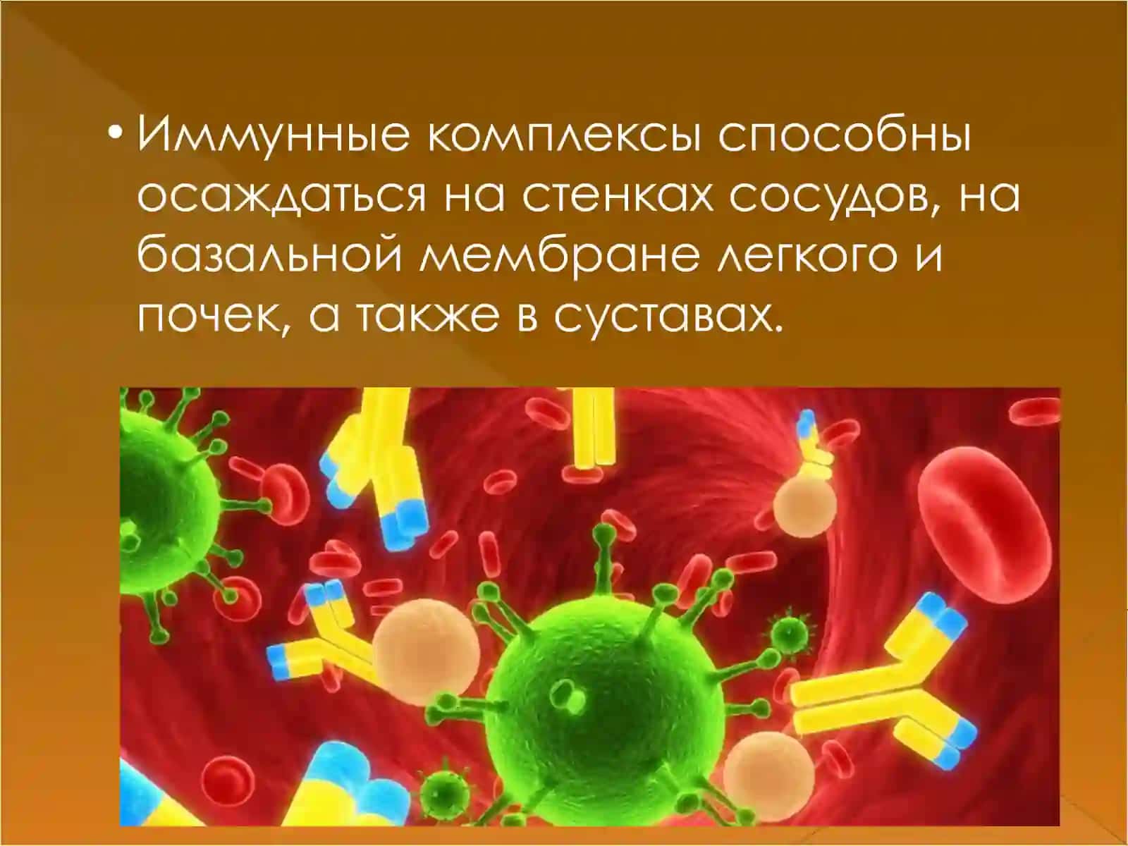 Иммунокомплексный тип повреждения 4
