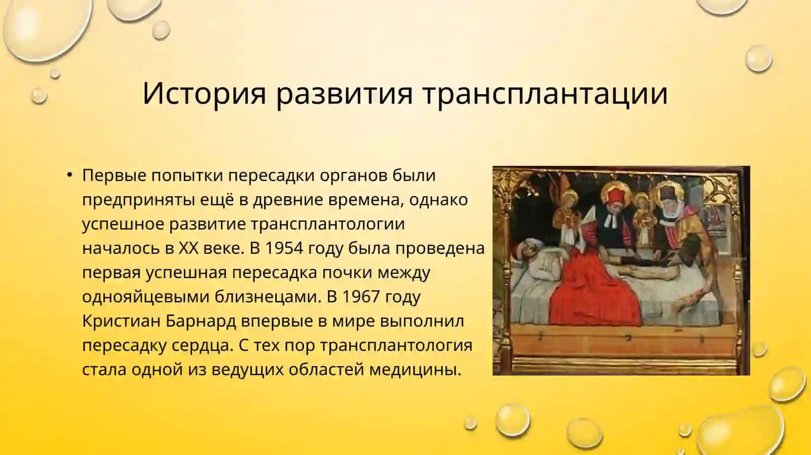 Развитие трансплантации на современном этапе 4