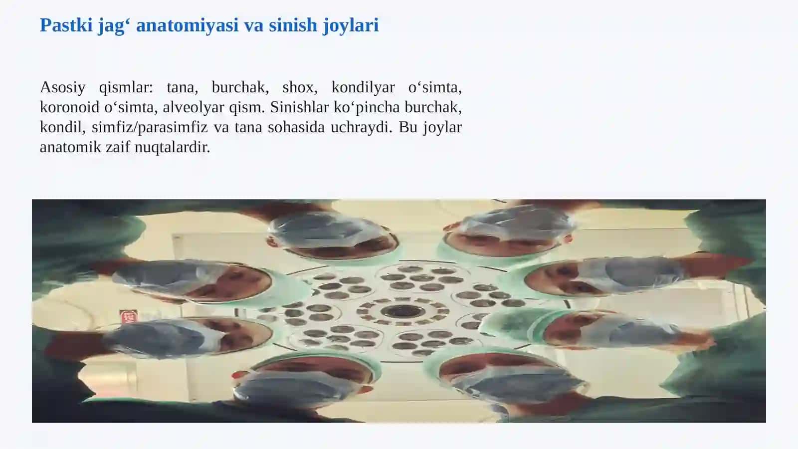 PASTKI JAG‘ SINISHI Sabablari, klinik belgilari, tashxisi, davolash va asoratlari. Pastki jag‘ sinishi haqida umumiy tushuncha 4