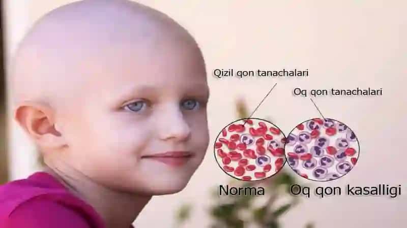 O’TKIR LEYKOZ 4