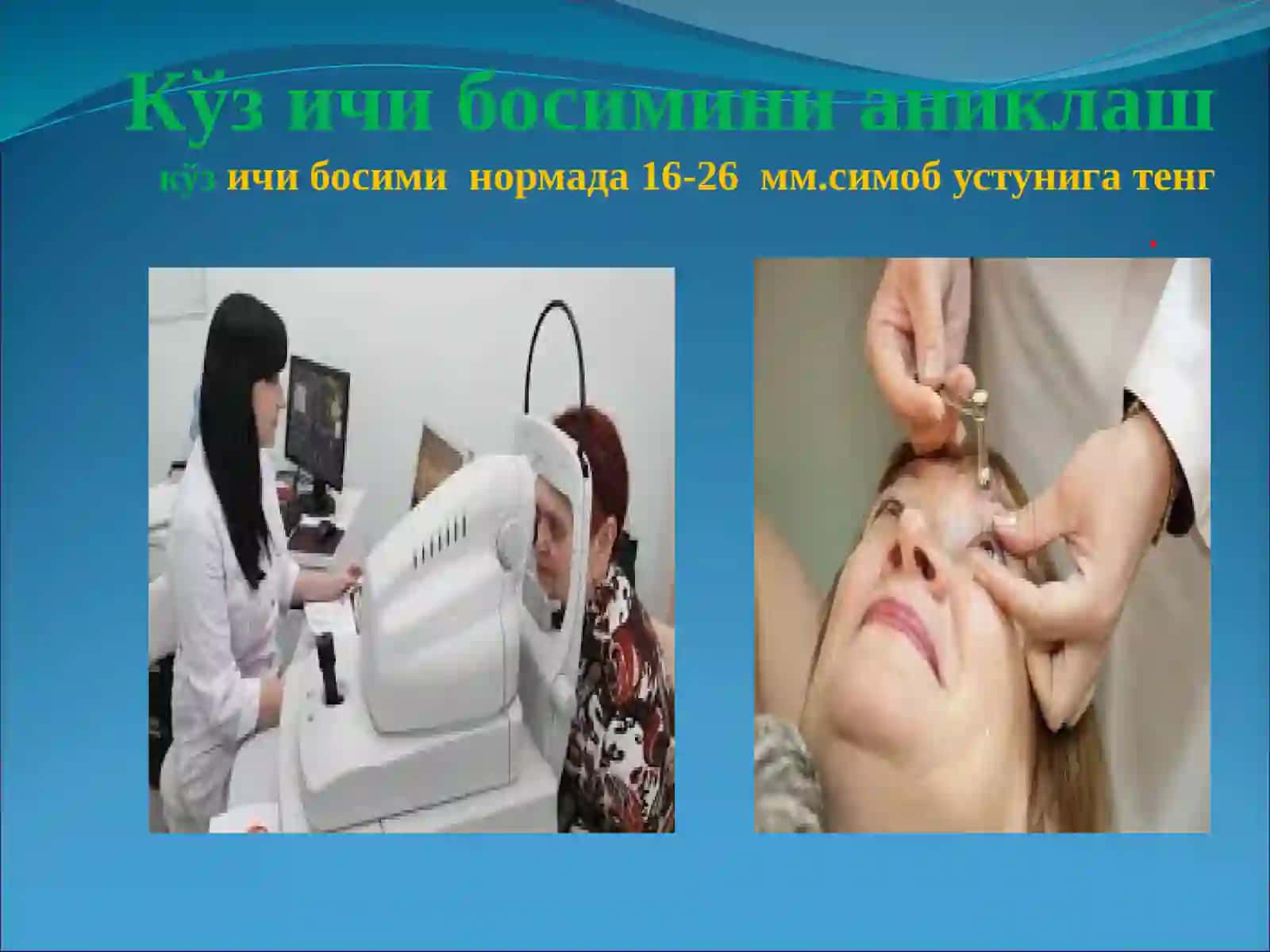 Глаукома 4