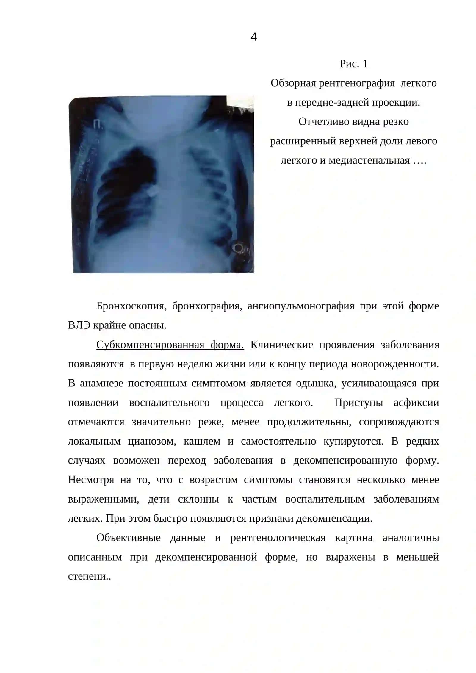 Диагностика и тактика лечения заболеваний органов грудной полости, требующих неотложного лечения 4