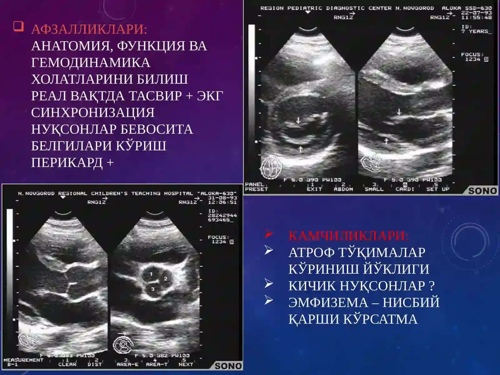 Yurak kasalliklarini Nur tashxisi 4