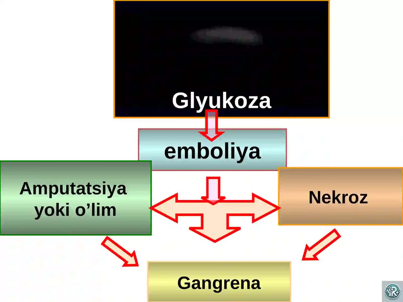 Qandli diabet 4