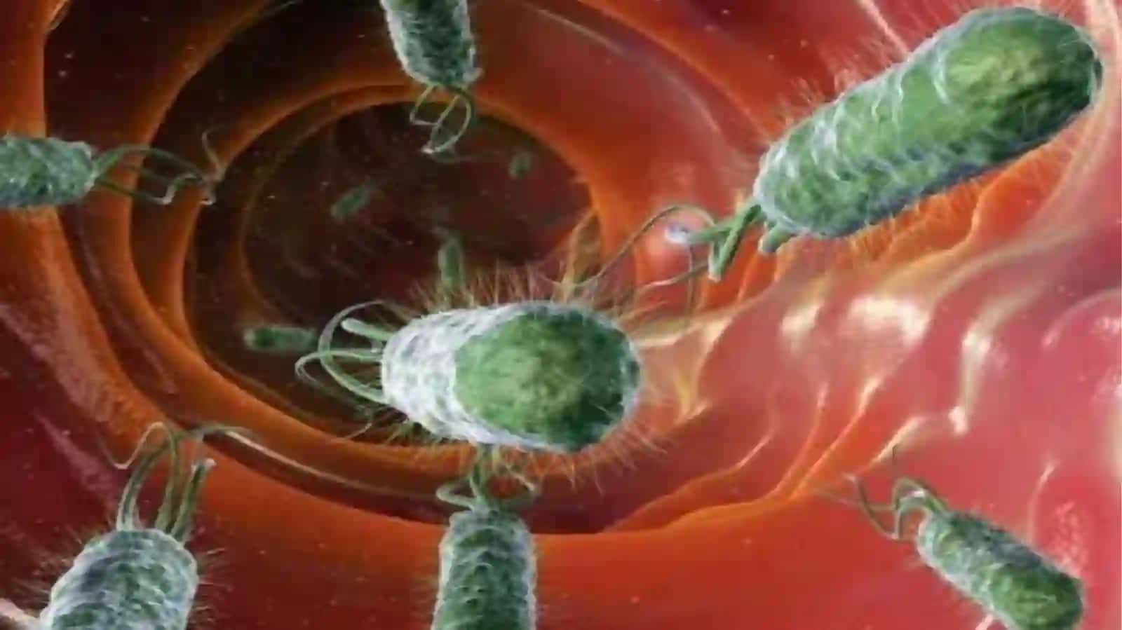O'tkirichak infeksiyalar epidemiologiyasi va profilaktikasi 4