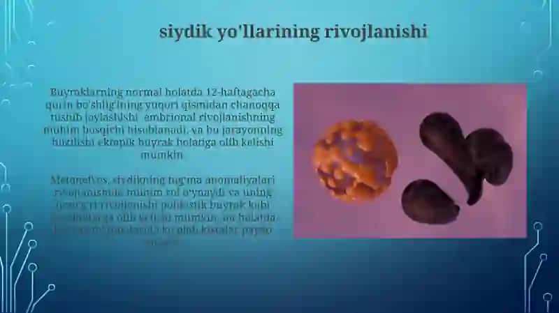 Siydik ajratish tizimi rivojlanishi va uning anomaliyalari 4