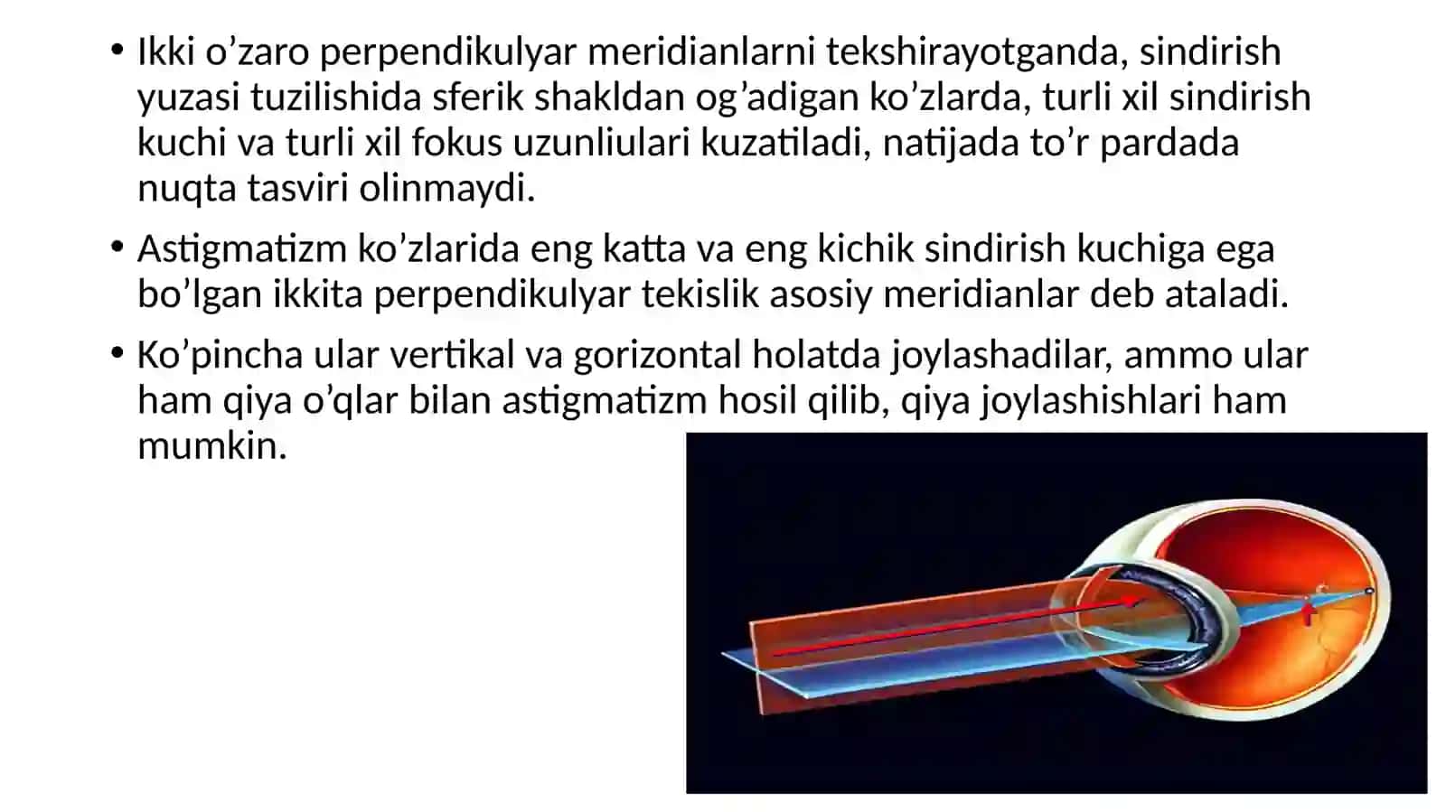 Astigmatizm 4