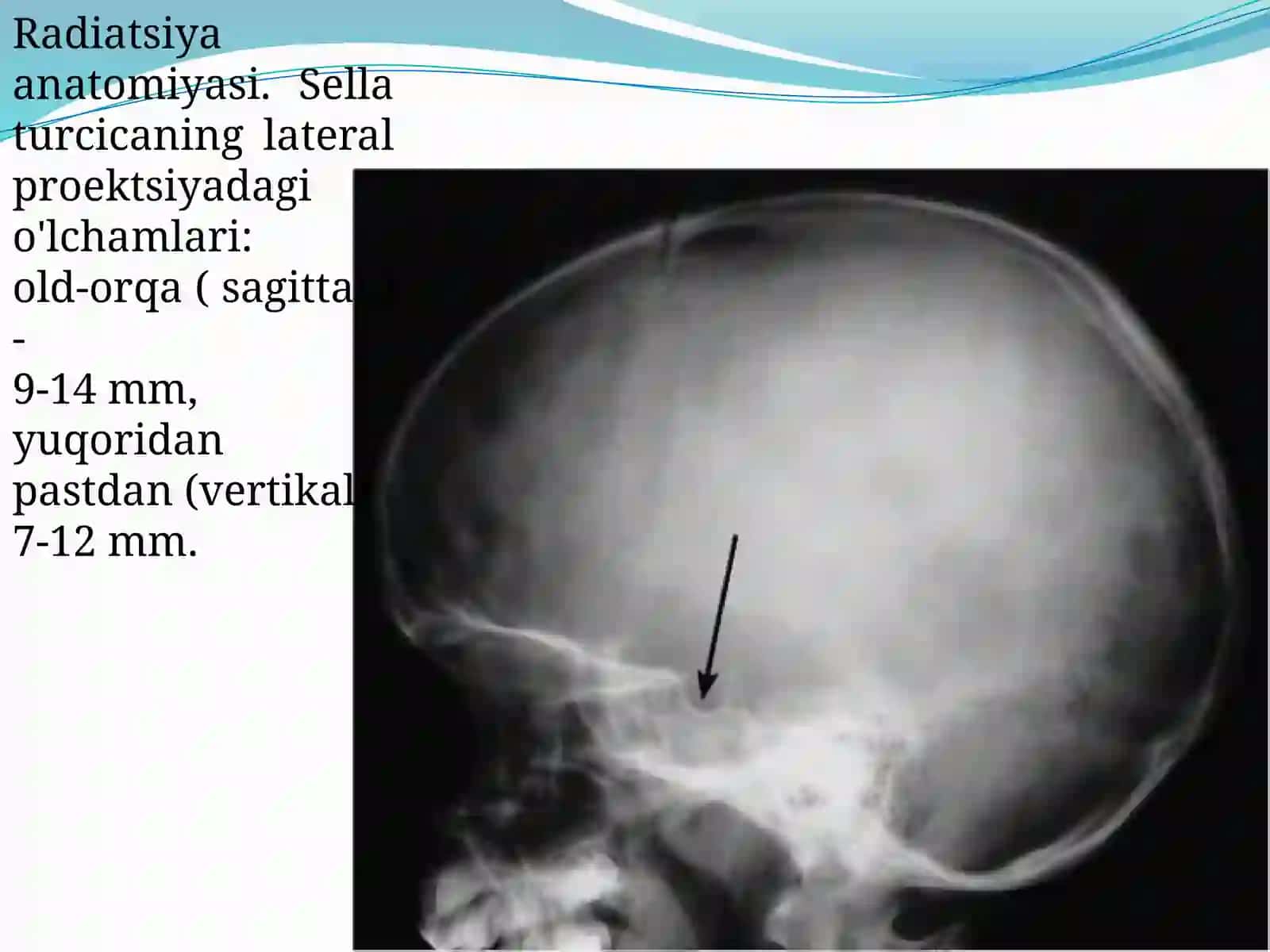 ENDOKRIN TIZIM KASALLIKLARINI RADIATSION DIAGNOSTIKASI 4