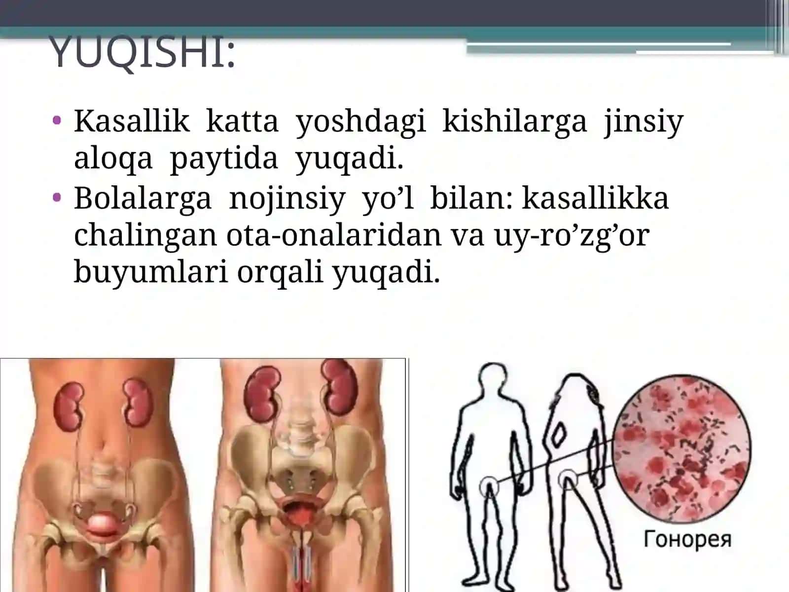 Nospetsifikinfeksiya 4
