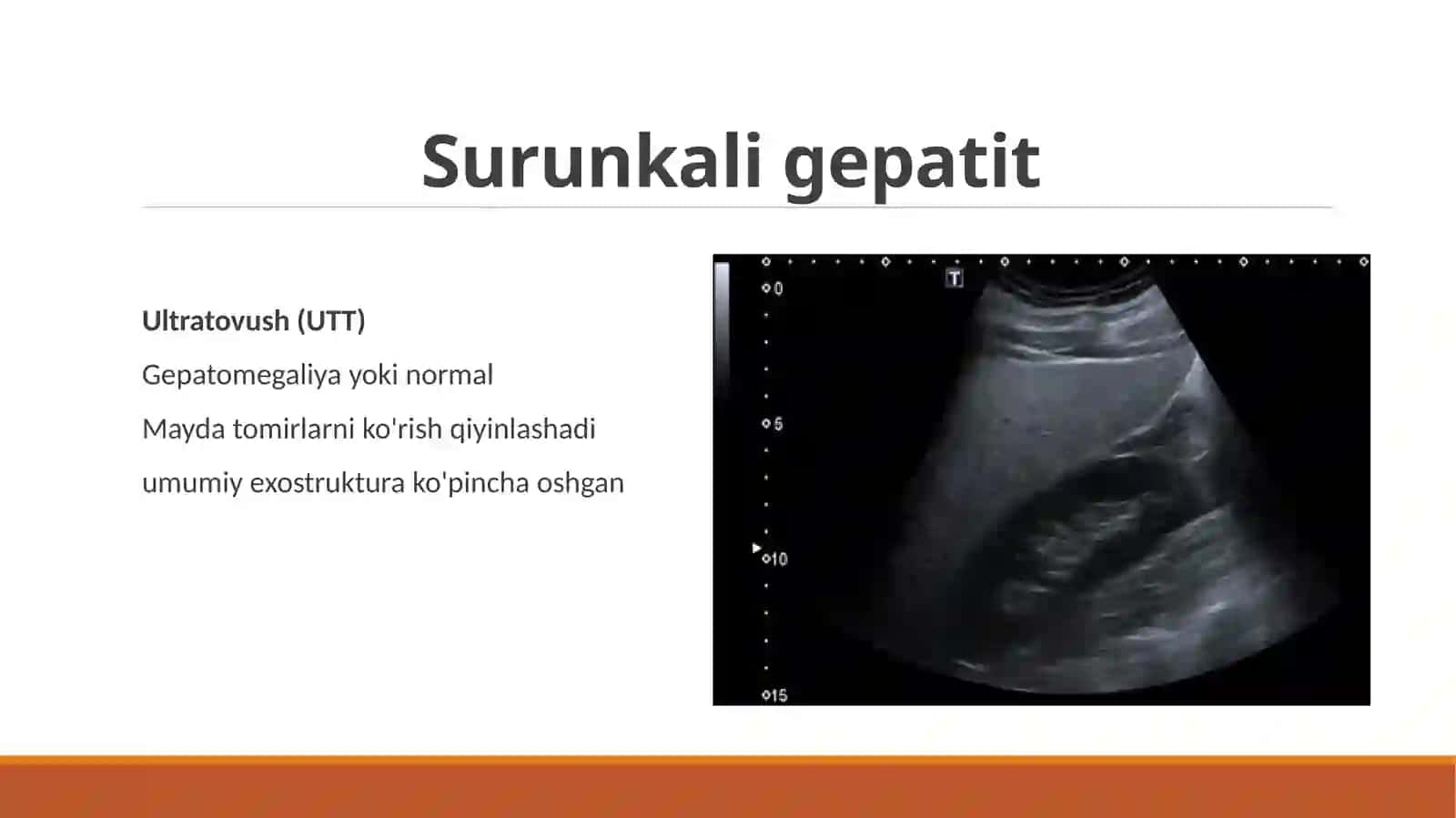 Gepatobiliar tizim nur diagnostikasi 4