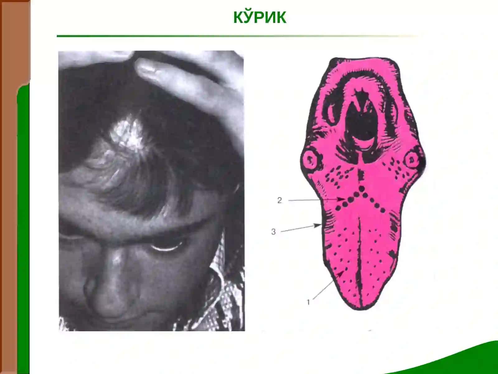 ЖИГАР ВА ЎТ ЙУЛЛАРИ КАСАЛЛИКЛАРИ БИЛАН КАСАЛЛАНГАН БЕМОРЛАРНИ ТЕКШИРИШ. ЖИГАР КАСАЛЛИКЛАРИДАГИ АСОСИЙ СИНДРОМЛАР 4