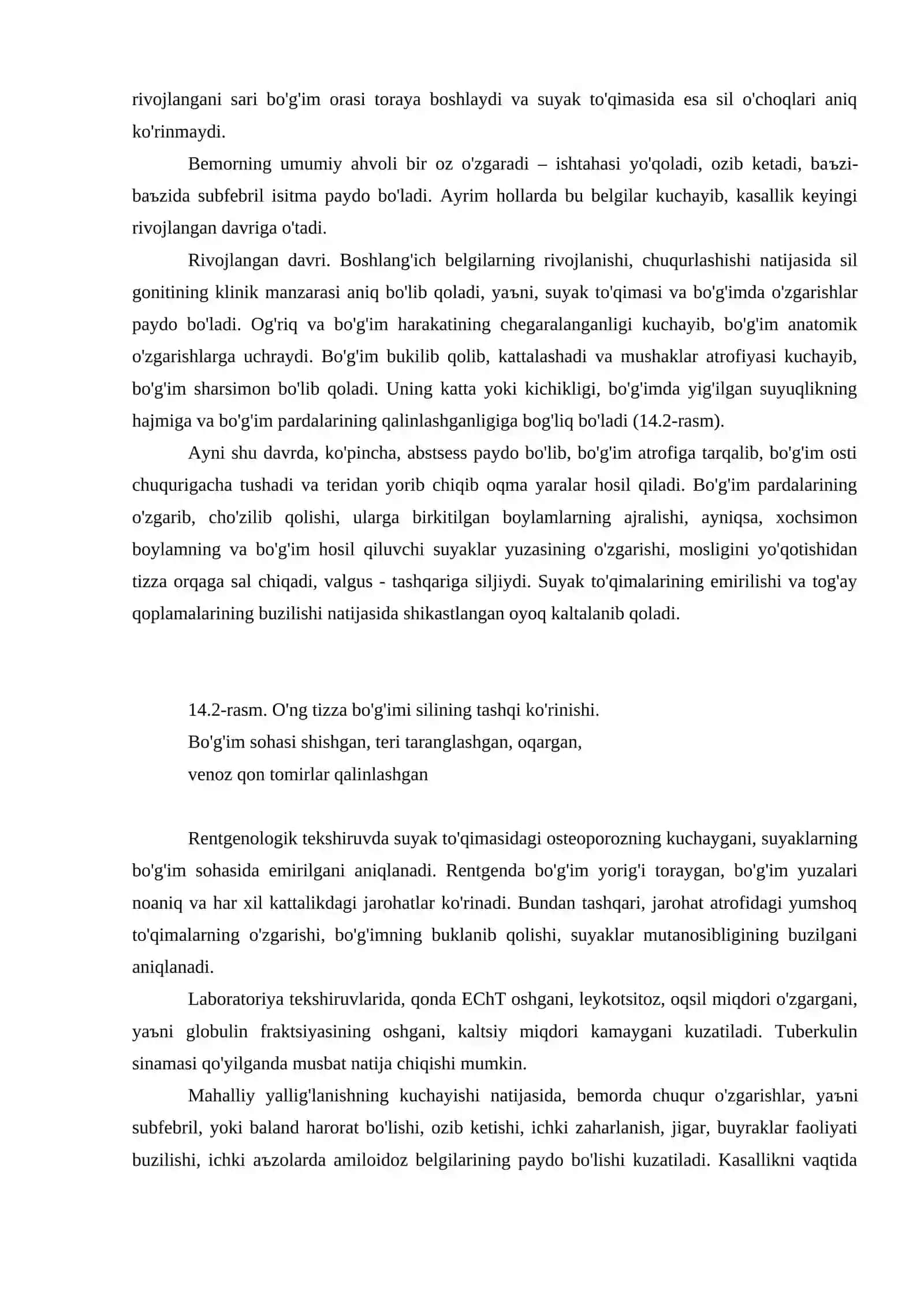 Tayanch-harakat aъzolar silining klinik kechishi 4