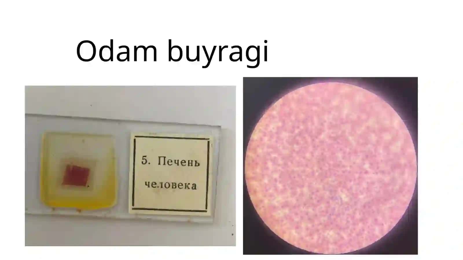 Jigarkupfer hujayralari davolash 4