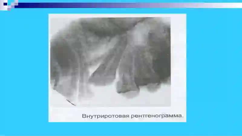 Ортодонтик беморларни махсус текшириш усуллари 4