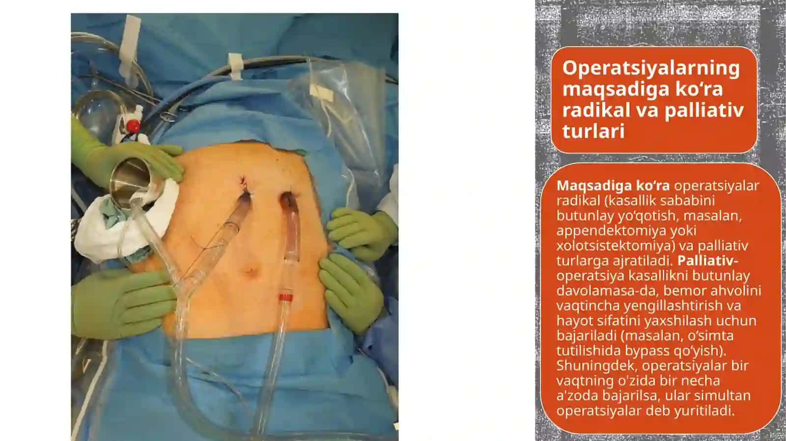 Xirurgik operatsiyalar 4