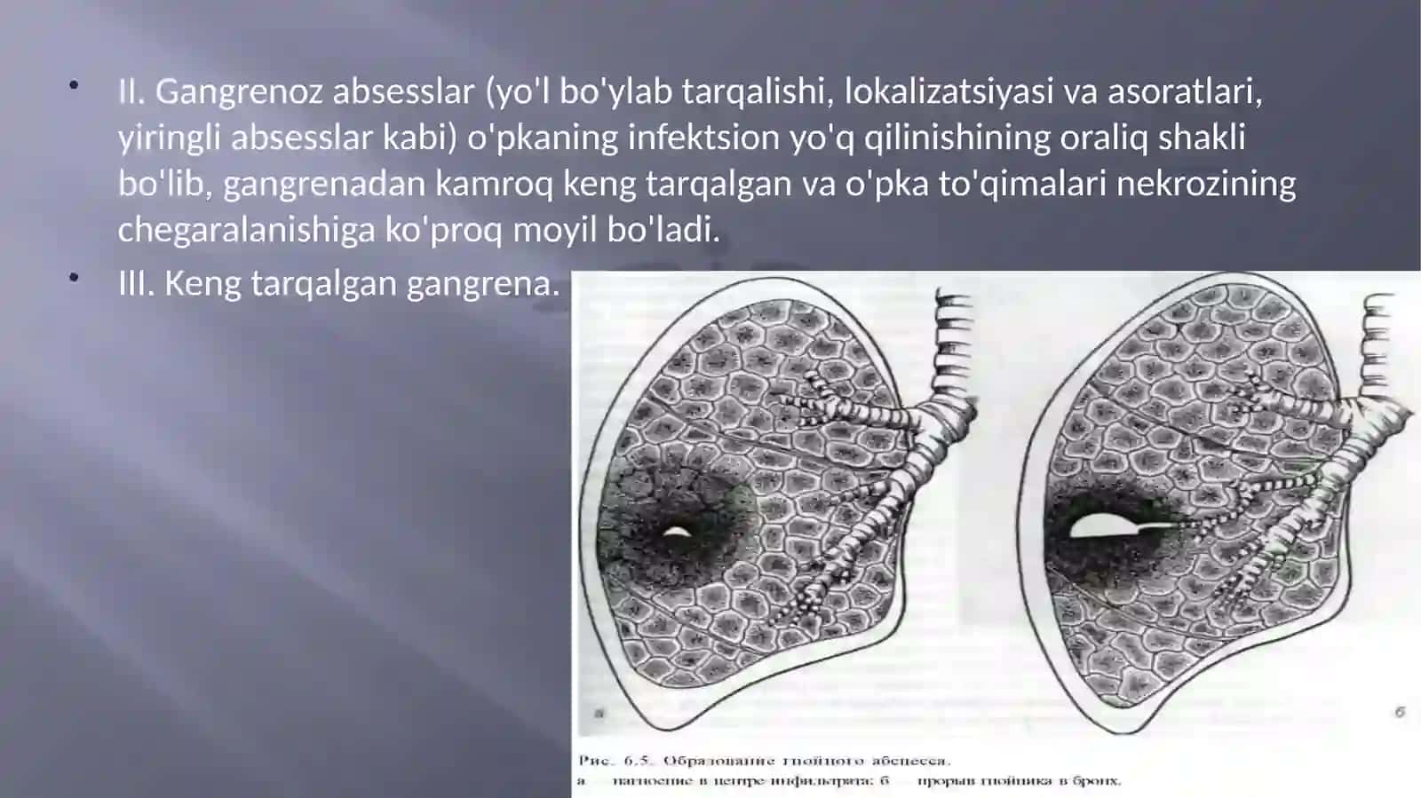 O’PKA ABSESSI VA GANGRENASI ETIOLOGIYASI, PATOGENEZI, KLINIKASI, LABORATORIYA TEKSHIRISH USULLARI, DAVOLASHCHORALARI 4