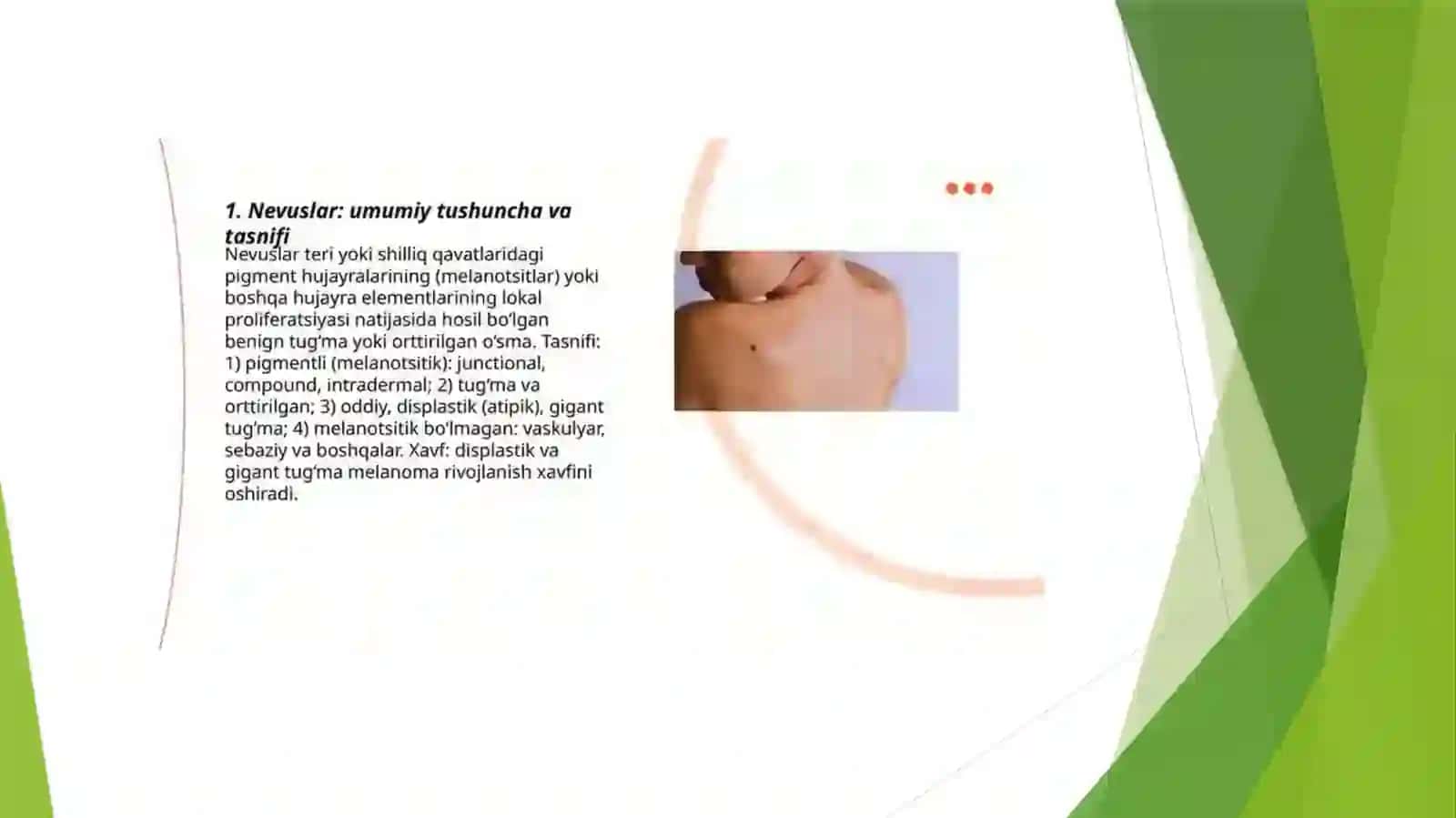 Nevuslarning asosiy xususiyatlari, xavfi, kelib chiqishi va ravishlari haqida ma'lumot 4