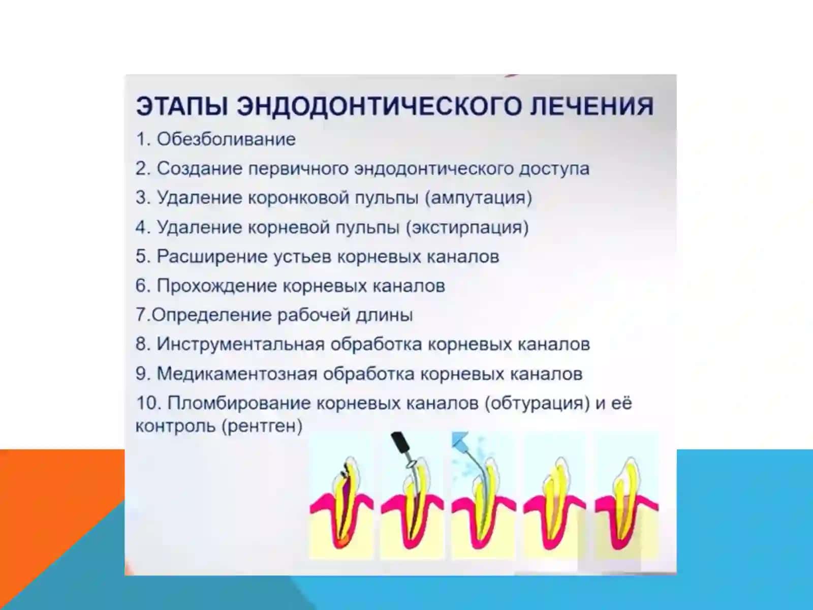 ЭНДОДОНТИЧЕСКИЙ ИНСТРУМЕНТАРИЙ 4