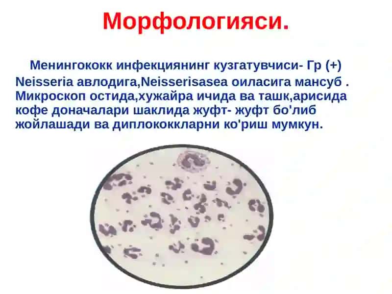 Менингококкинфекцияси 4