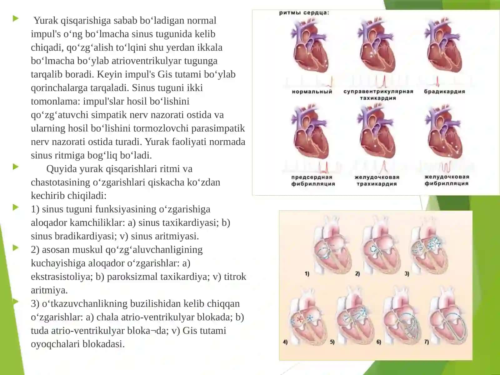 Amaliymashg’ulot № 5. YuQTTning ba’zi kasalliklari va aritmiyalar. Jismoniyishqobiliyatnianiqlash. PWC 170vaNovakkitestlari 4