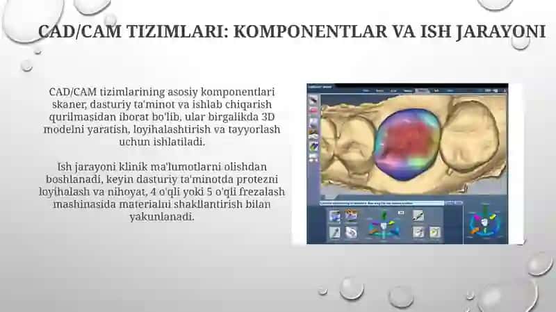 CAD/CAM texnologiyalari tish qollashda 4