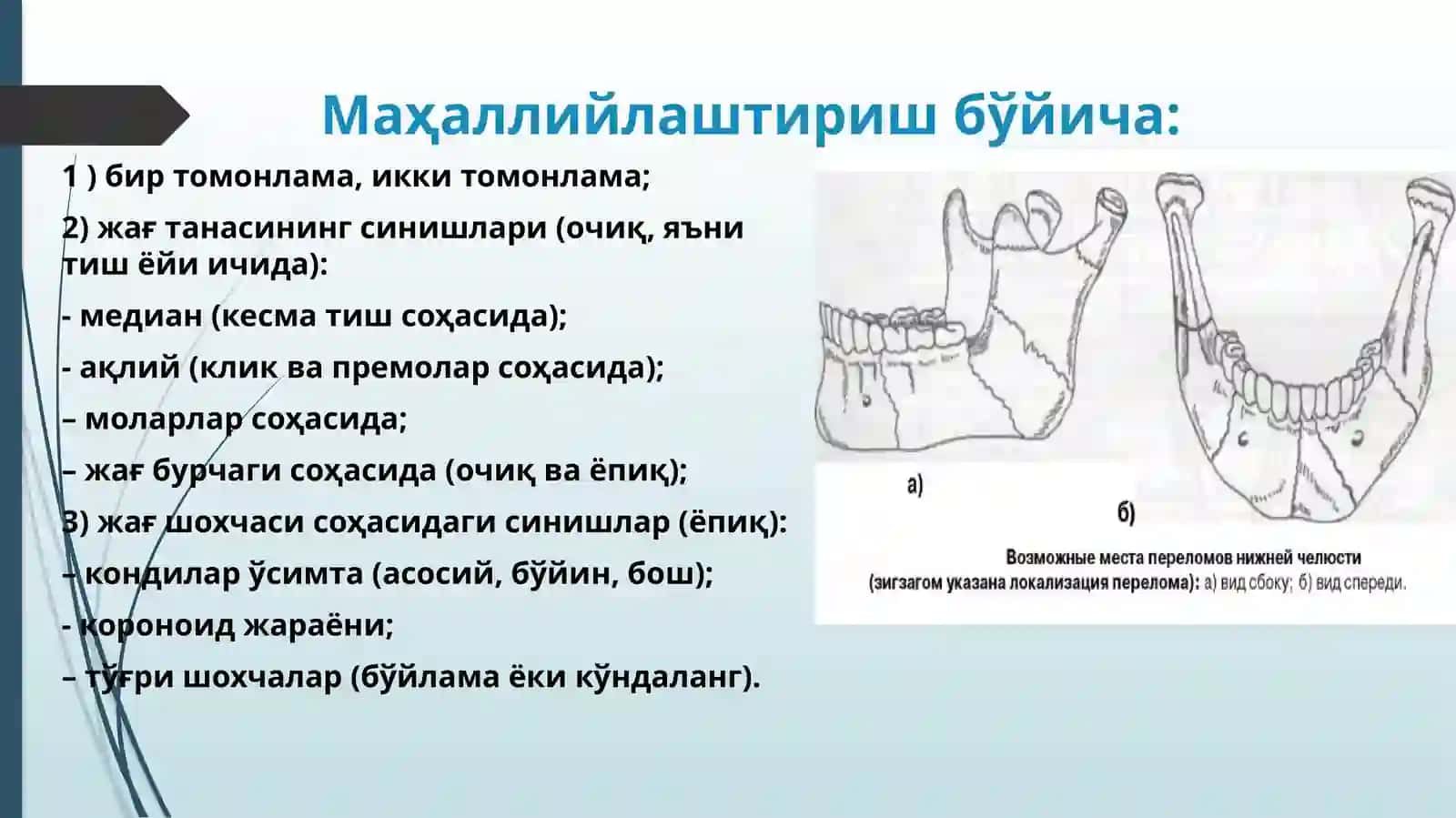 Пасткижағнинг синиши 4