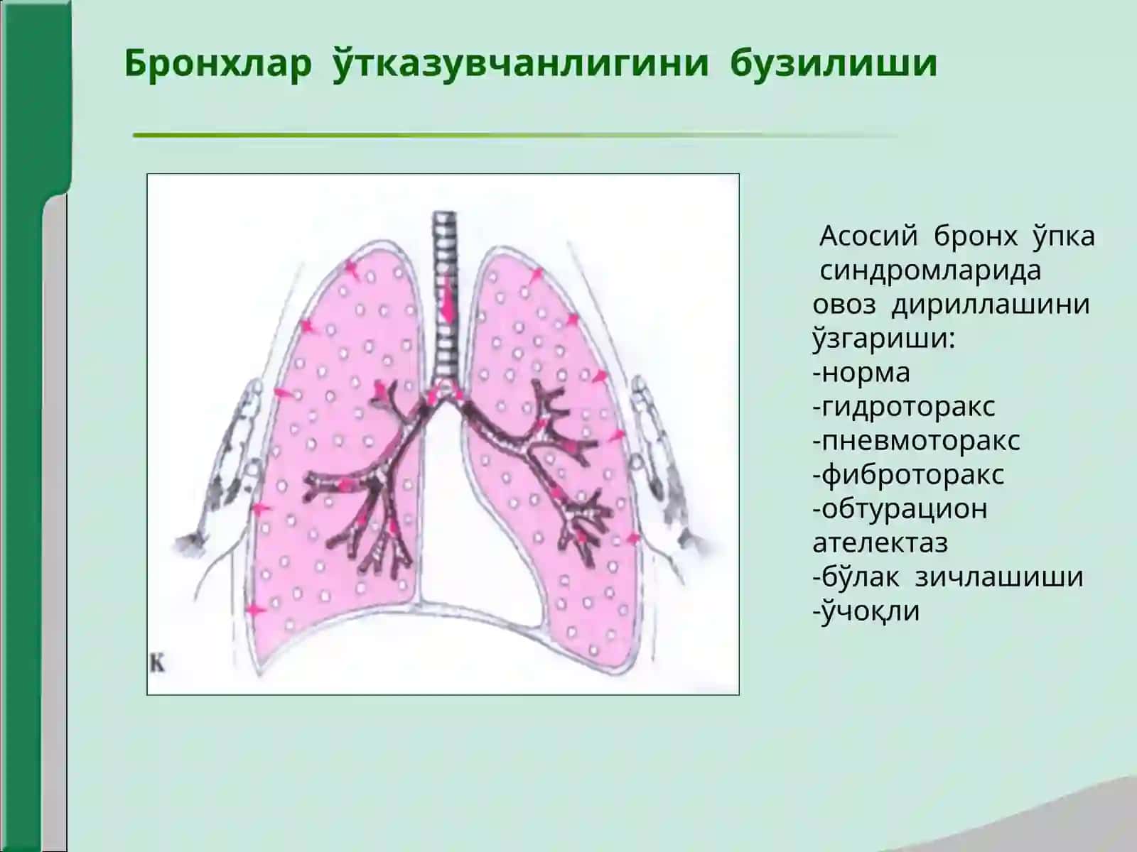 Нафас органлари касалликларида асосий клиник синдромлар. Бронхлар ўтказувчанлигини бузилиши, ўпка тўқимасини ҳаво билан тўлишини оши6 кетиши, ўпка тўқимасини зичлашиши, плевра бўшлиғида ҳаво ва суюқликни тўпланиши, ўпка тўқимасида ковак (бўшлиқ) ҳосил бўлиш синдроми 4