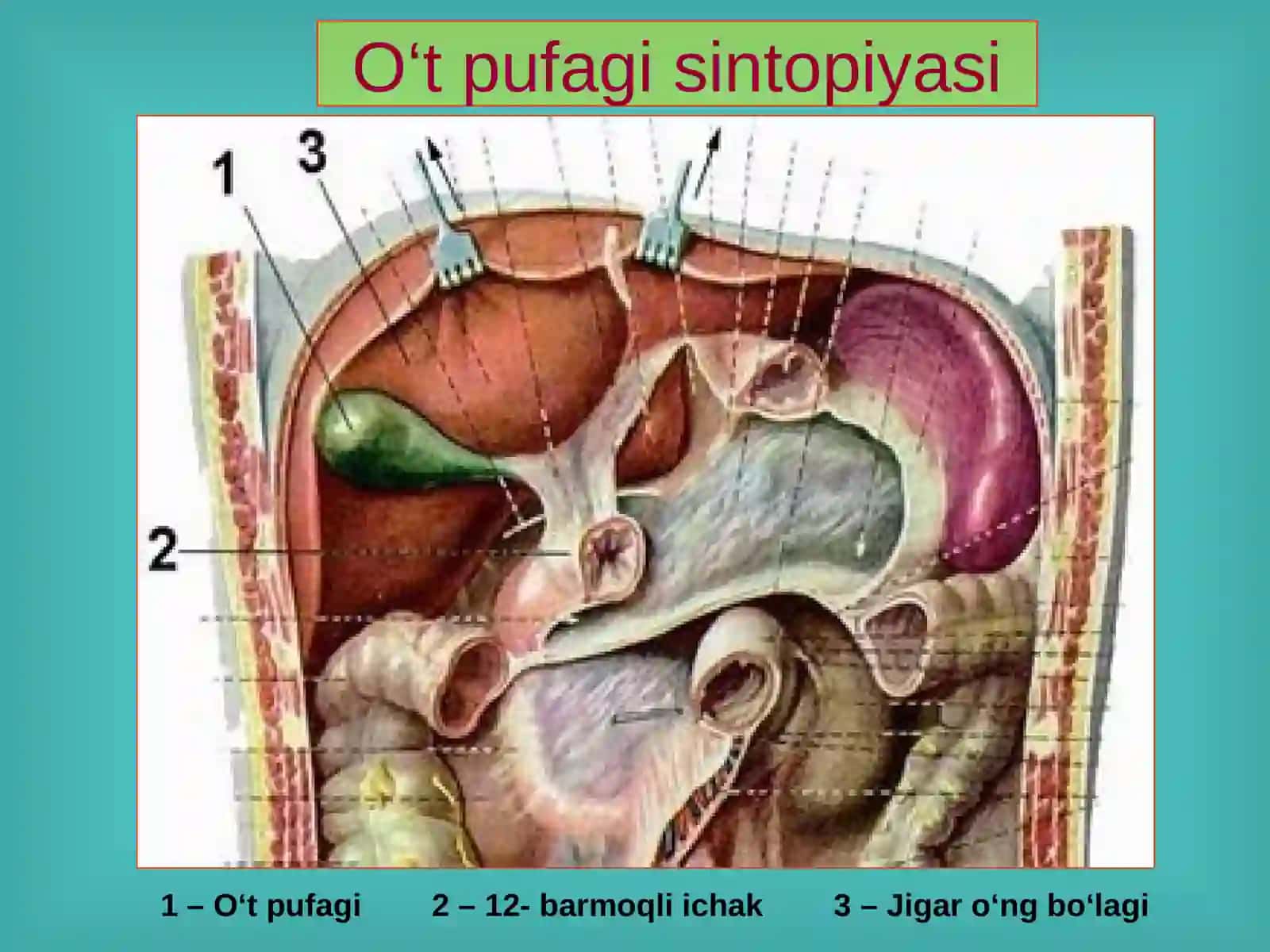 O't tosh kasalliklari, xolisistitlar diagnostikasi ppt 4