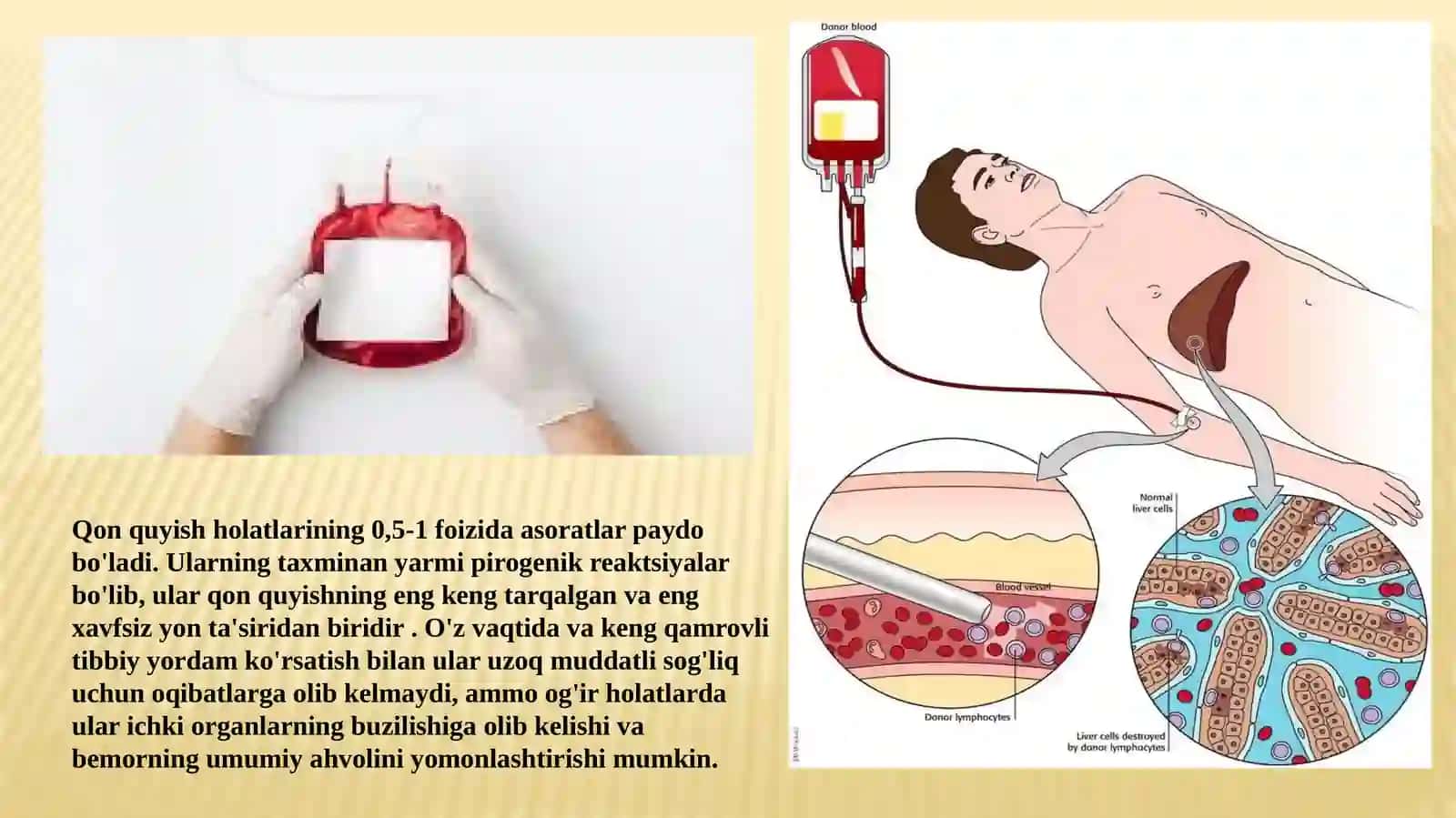 Pirogen reaksiyalar : sabablari , klinikasi va diagnostikasi,birinchi yordam 4