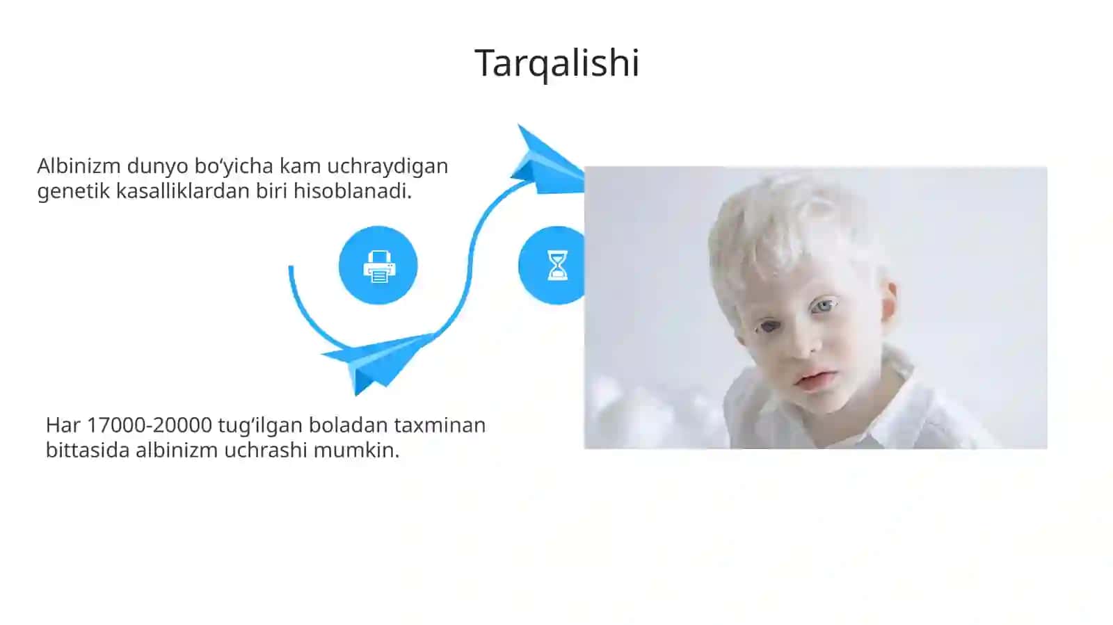 Albinizmkasalligi 4