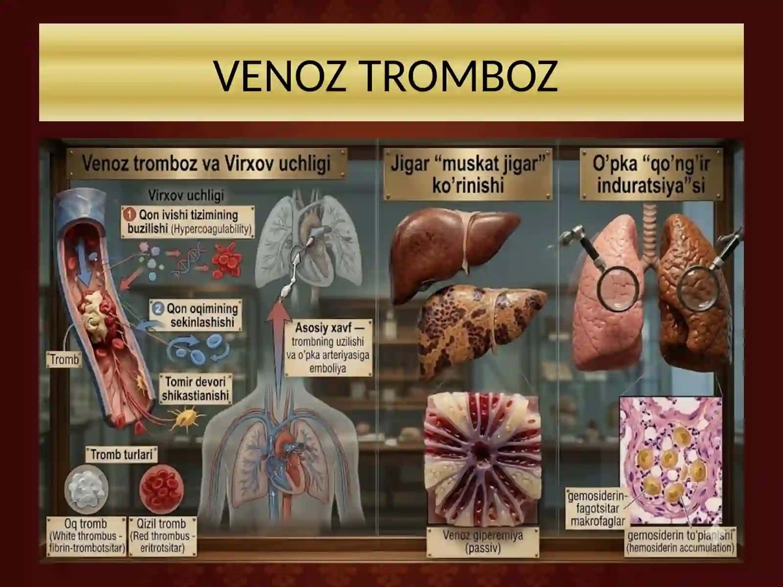 VENA VA LIMFA TOMIRLARI PATOLOGIYASI TOMIRLARGA ARALASHISHDAGI PATOLOGIYA (INTERVENSII) PREZENTATSIYA 4