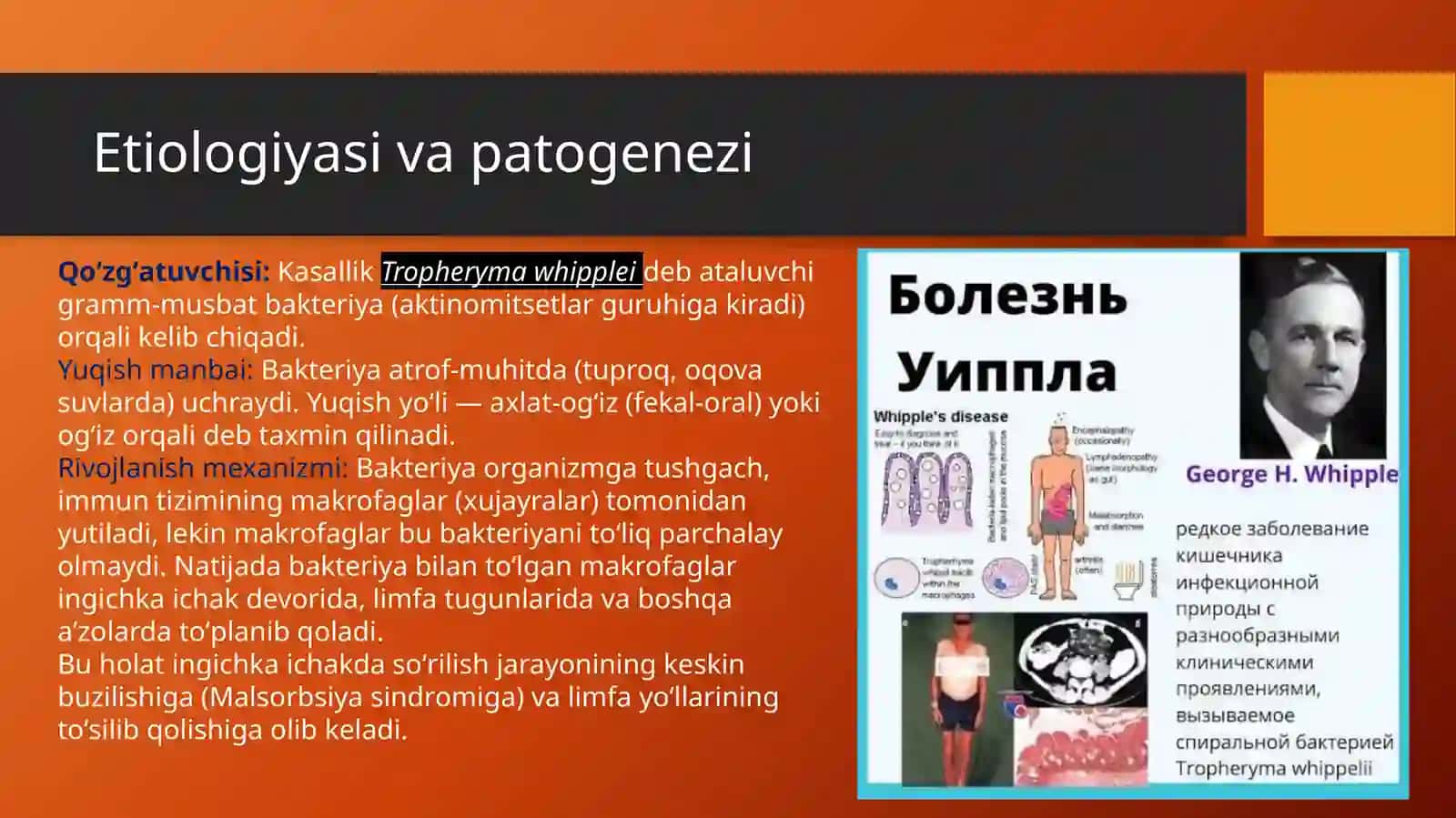 Uippl kasalligi va Ichak ta’sirlanish sindromi (ITS): etiologiya, diagnostika va davolash 4