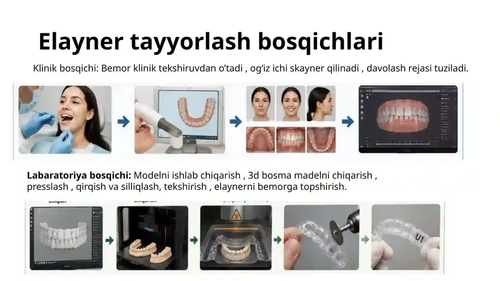 Elaynerlar 4
