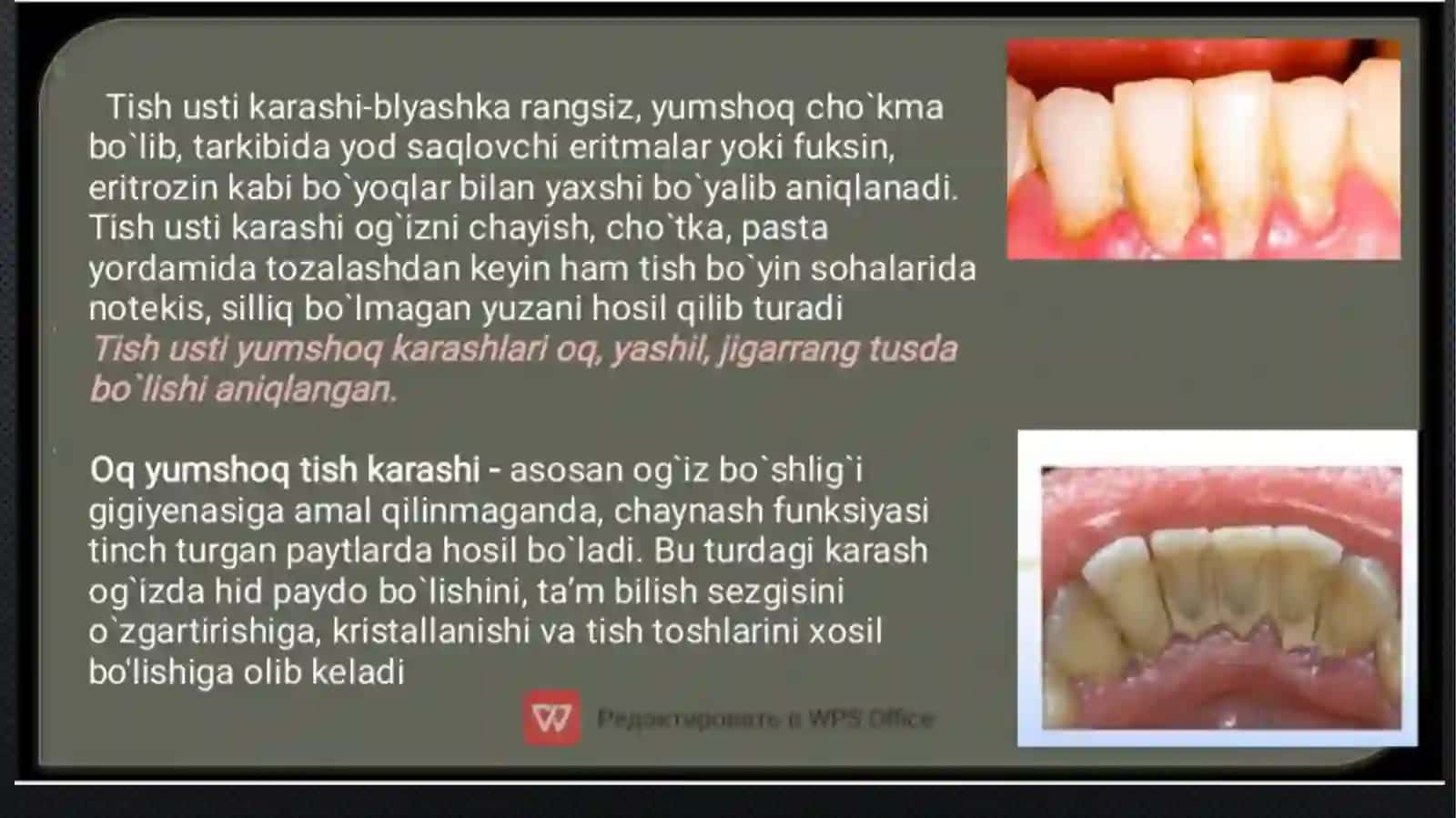 tish karashlarini tozalash usullari 4