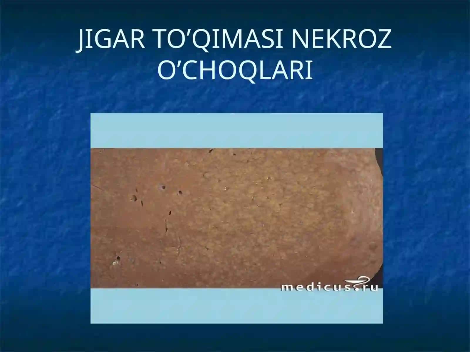 JIGAR SERROZI 4