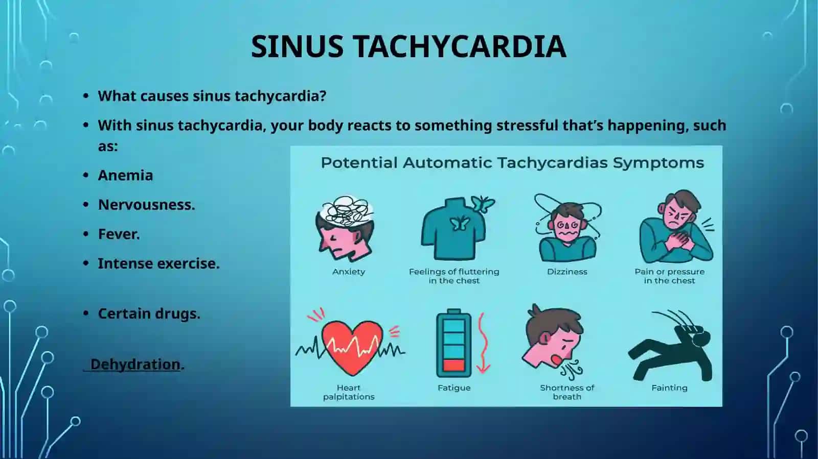 Supraventricular arrhythmia 4