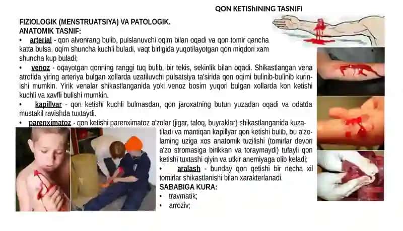 Qon Ketish, Qon Yuoqtish 4