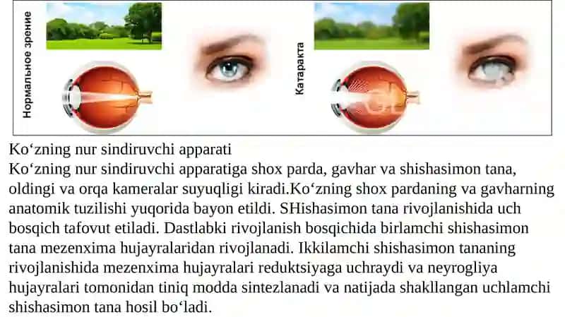 Ko‘z. Ko‘zning tuzilishi, ko‘z pardalari, g‘ovaklari, kamalak  parda, oldingi va keyingi kameralari, shishasimon tana. 4
