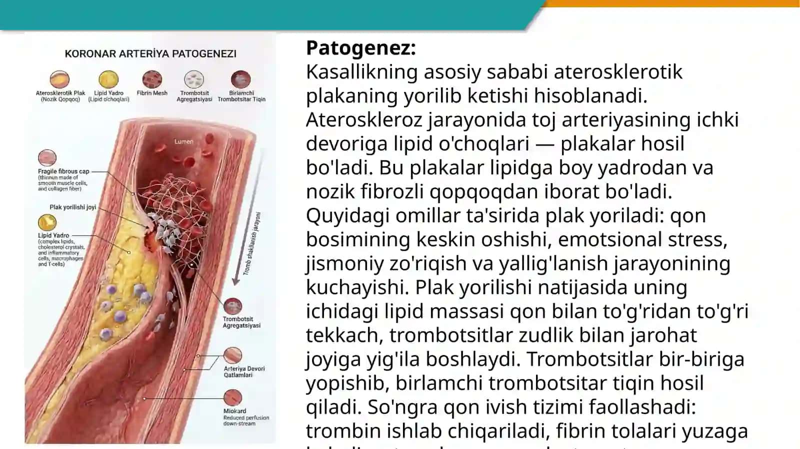 O'TKIR KORONAR SINDROM PREZENTATSIYA 4