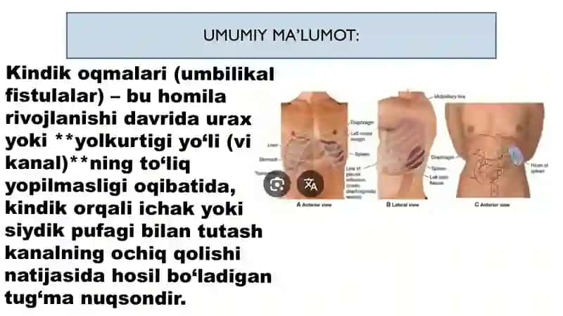 Kindik oqmalari 4