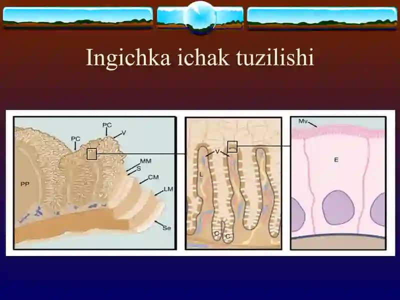 SURUNKALI ENTERIT. SURUNKALI KOLIT 4