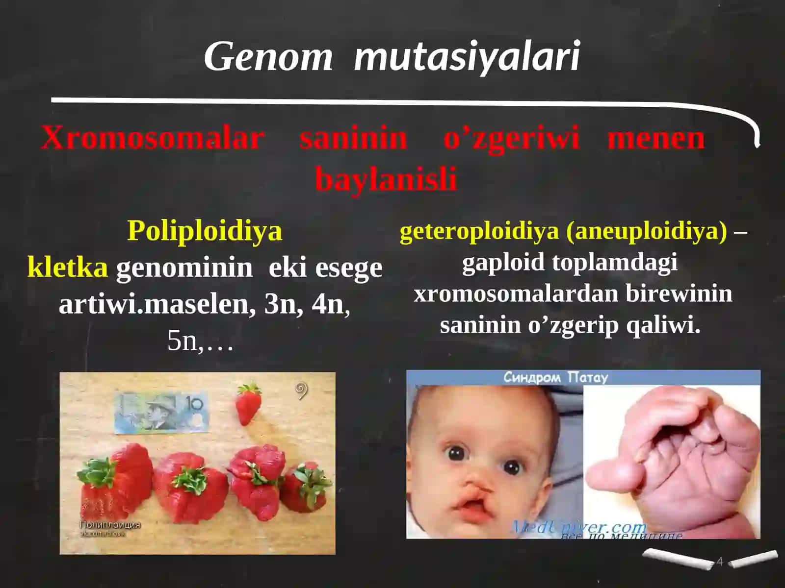 Adamlarda ushirasatugin nasillik kesellikler 4
