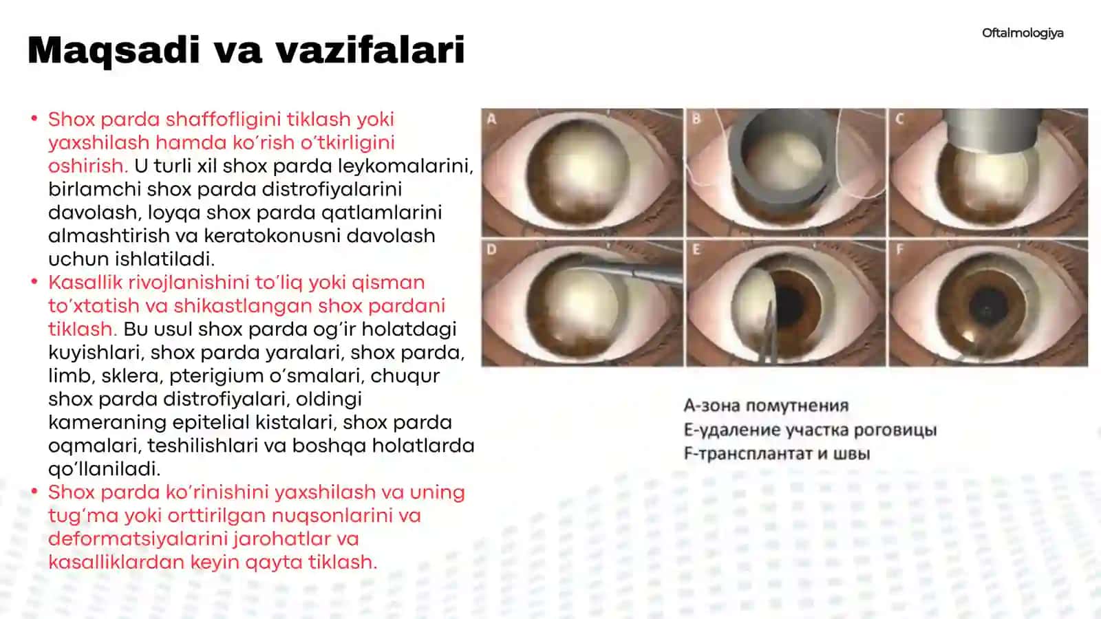 Keratoplastika va uning turlari 4
