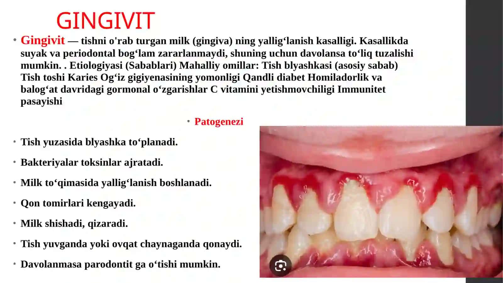 Parodont toʻqima uning tuzilishi va patalogiyalari haqida taqdimot 4