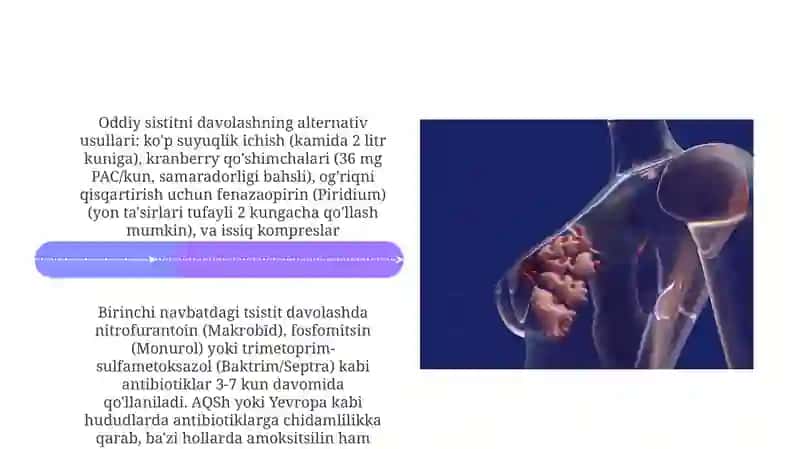 Sistit va uning davolash usuli 4