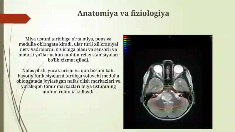 Bosh miya o'zagi o'smalari 4