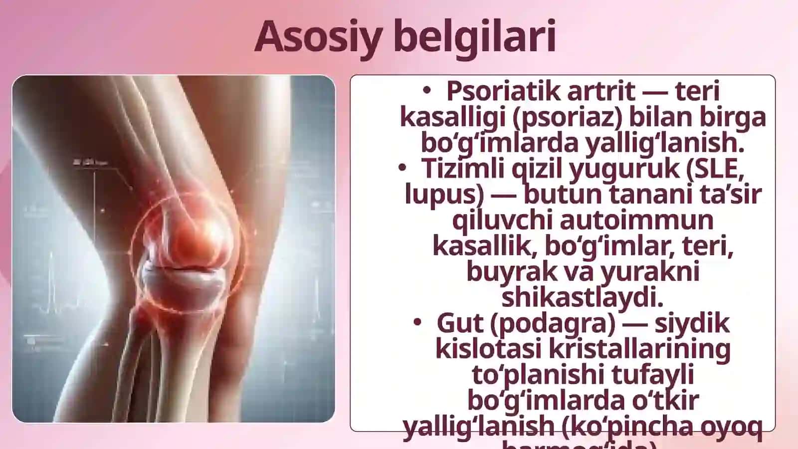 Revmatik kasalliklar. Sinovit 4